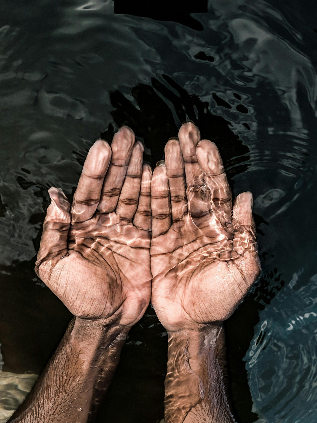 La piel seca y el agua: ¿Amigas o enemigas?